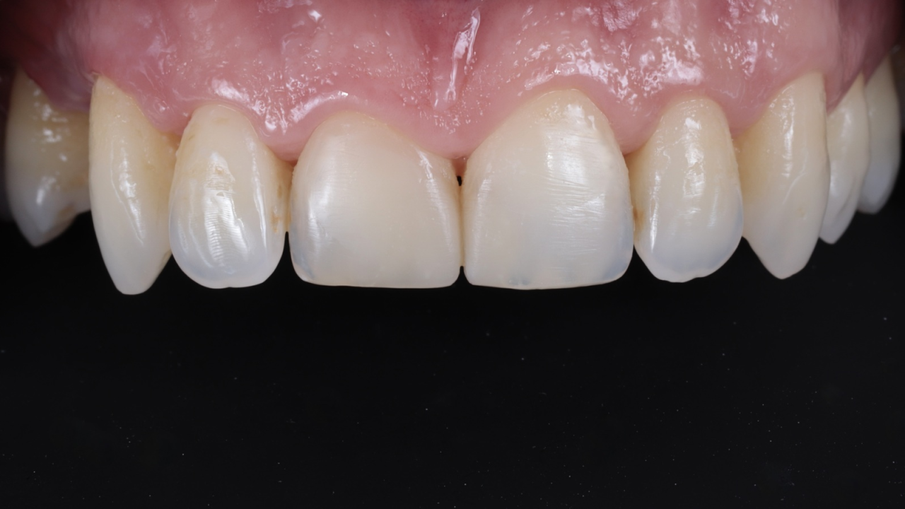 Final result after rehydration