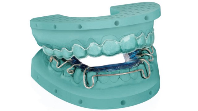 3D printed orthodontic model for wire bending 