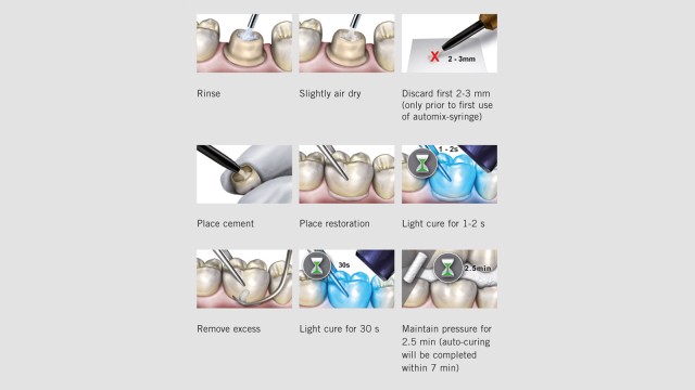 Step-by-step application